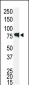 IRAK Antibody (C-term)