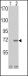 IRAK Antibody (C-term)