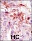 IRAK Antibody (C-term)