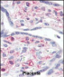 IRAK Antibody (C-term)