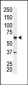 IRAK2 Antibody (N-term)