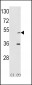 AIK Antibody (N-term)