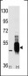 COT (MAP3K8/MEKK8) Antibody (C-term)