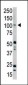 PRK2 Antibody (C-term)