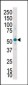 SGK2 Antibody (C-term)