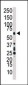 TAK1 Antibody (C-term)