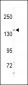 NIK Antibody (C-term)