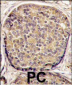 PI3KCB Antibody (C-term)