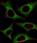 PI3KCD Antibody (C-term)