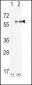 PIP5K1A Antibody (N-term)