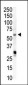 PIP5K1A Antibody (N-term)