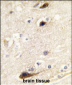 PIP5K1B Antibody (N-term)
