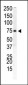 PIP5K1B Antibody (N-term)