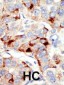 Mouse Dnmt2 Antibody (N-term)