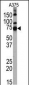 HDAC10 Antibody (N-term)