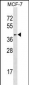 HDAC11 Antibody (N-term)