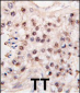 HDAC11 Antibody (C-term)