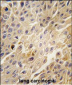 ADRBK1 Antibody (C-term)