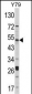 AKT1 Antibody (C-term)