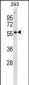 AKT2 Antibody (Center)