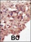 DAPK2 Antibody (N-term)