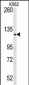 LATS1 Antibody (N-term)