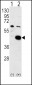 PDK2 Antibody (C-term)