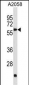 PDK3 Antibody (N-term)