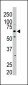 PKLR Antibody (N-term)