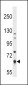 PKLR Antibody (N-term)