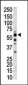 PKLR Antibody (C-term)