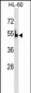 PKLR Antibody (C-term)