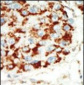 AMPK beta (PRKAB1) Antibody (N-term)