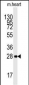 AMPK beta (PRKAB1) Antibody (N-term)