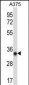 AMPK beta2 (PRKAB2) Antibody (N-term)