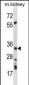 AMPK beta2 (PRKAB2) Antibody (N-term)