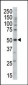 PRKAG3 Antibody (Center)