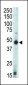 Protein Kinase A regulatory subunit I beta Antibody (N-term)