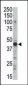 PKA 2 beta (PRKAR2B) Antibody (N-term)