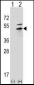 PKA 2 beta (PRKAR2B) Antibody (N-term)