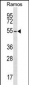 PKA 2 beta (PRKAR2B) Antibody (N-term)