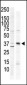 CAMK1 Antibody (C-term)