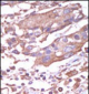 CAMK2A (CAMK2 alpha) Antibody (C-term)