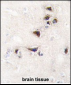 CAMK2A (CAMK2 alpha) Antibody (C-term)