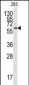 CAMK2A (CAMK2 alpha) Antibody (C-term)