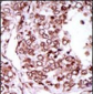 CAMK2G (CAMK2 gamma) Antibody (C-term)