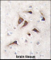 CAMK2D (CAMK2 delta) Antibody (C-term)