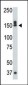 DAPK1 Antibody (C-term)