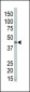 DAPK2 Antibody (N-term)