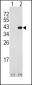 DAPK2 Antibody (N-term)